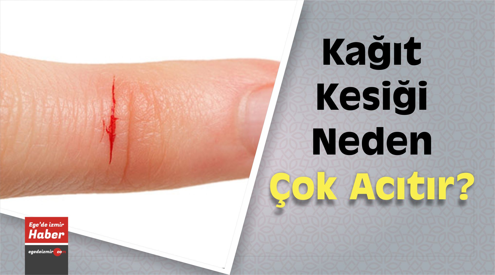 Kağıt Kesiği
