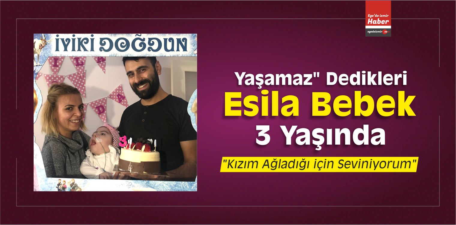 Doktorların Yaşamaz Dediği Bebek 1 Yaşında Doktorların Yaşamaz Dediği Bebek 1 Yaşında