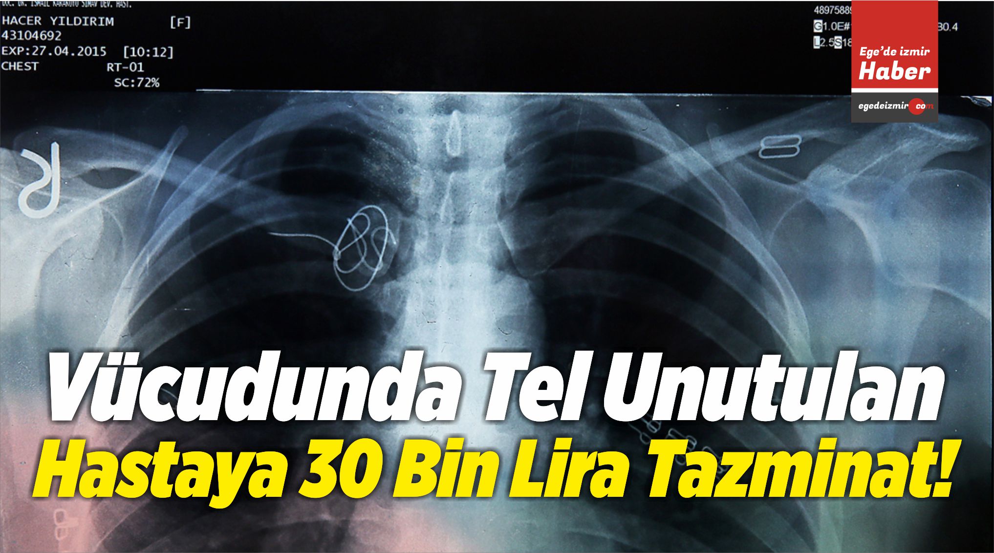 30 Bin Lira