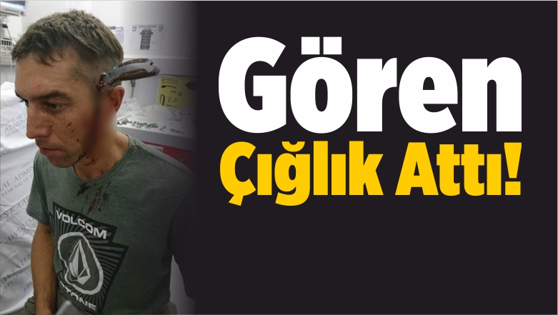 Attı