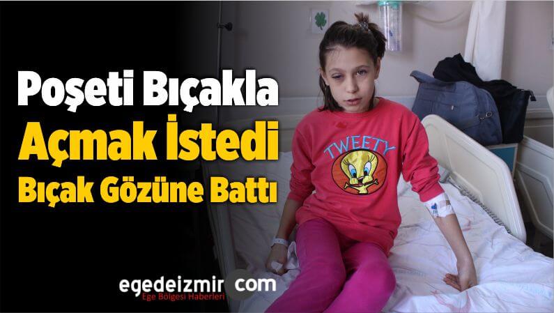 kornea nakli oldu