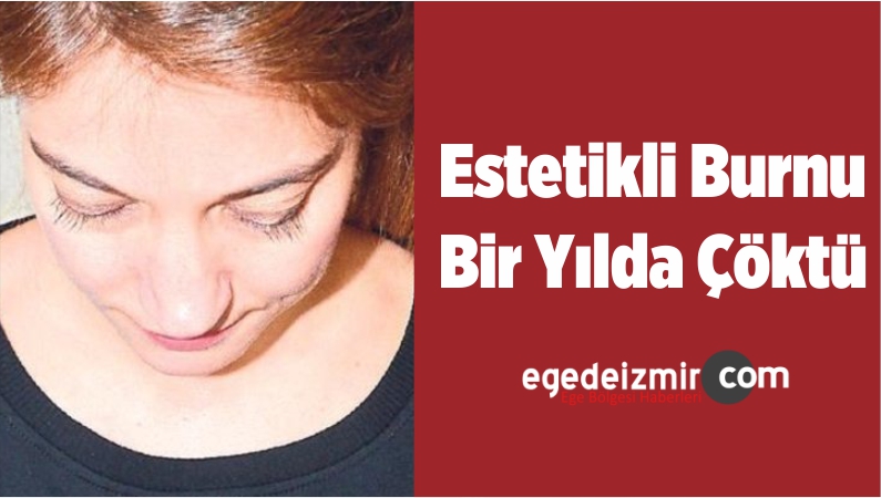 burun estetiği