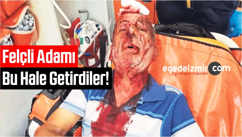 Bu Hale Getirdiler!