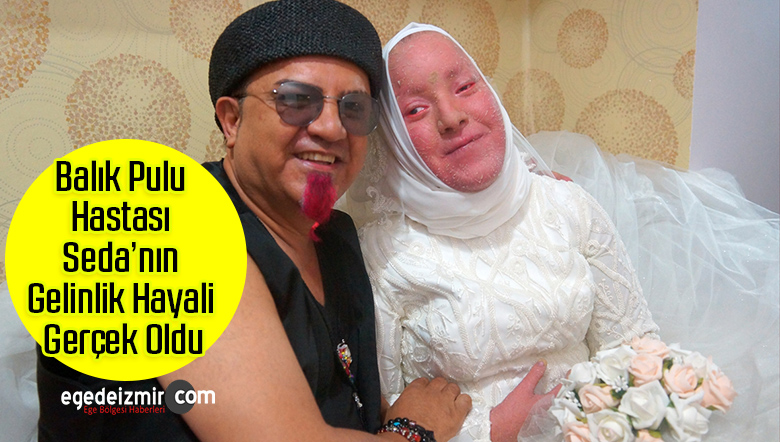 blaık pulu hastası