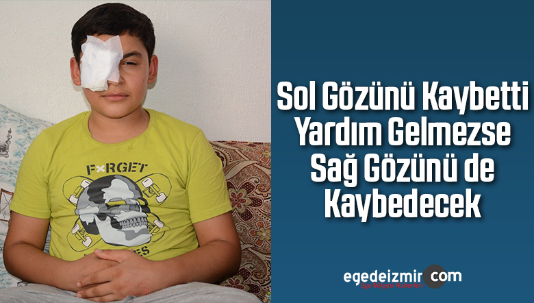 Sol Gözünü