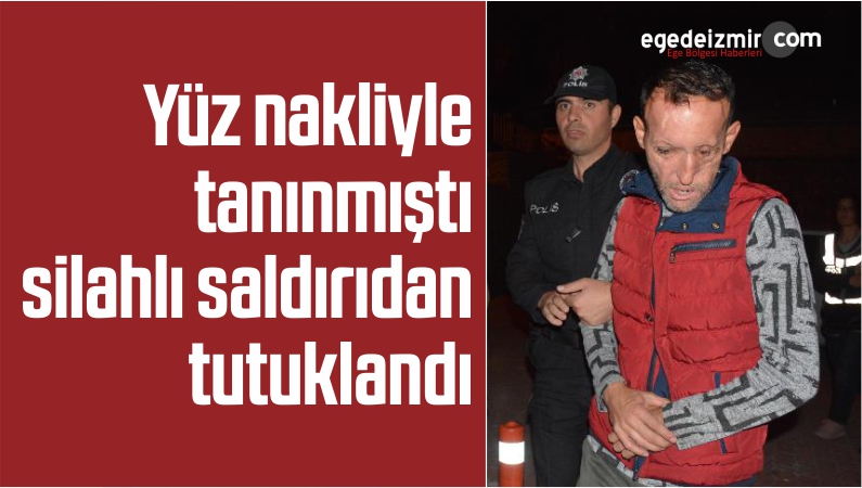 Yüz nakliyle tanınmıştı