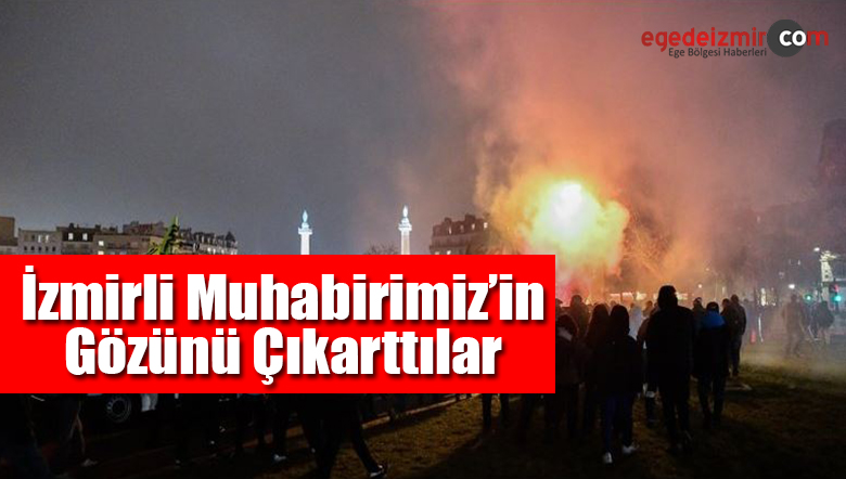 gözünü