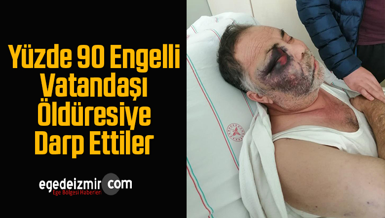 yüzde 90 engelli