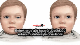 Bebeklerde göz kapağı düşüklüğü erken müdahaleyle onarılabilir