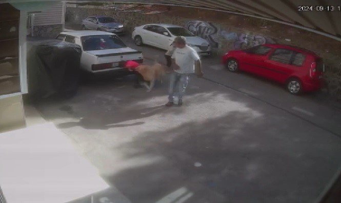 İZMİR'DE SEVDİĞİ KÖPEĞİN SALDIRISINA UĞRAYAN ÇOCUK YARALANDI