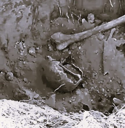 5 TOPRAK KÜPÜN İÇERİSİNDE İNSANA AİT KEMİK PARÇALARI BULUNDU