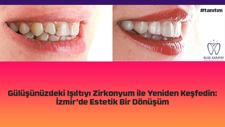 zirkonyum 2