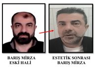 AMELİYAT İLE YÜZÜNÜ DEĞİŞTİREN FİRARİ CİNAYET ZANLISI, 7 YIL SONRA YAKALANDI