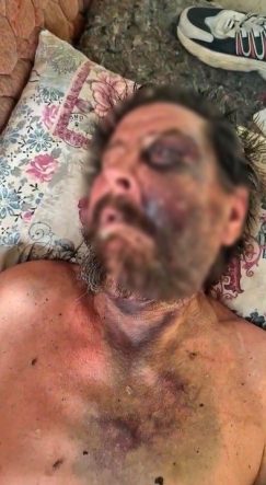 "ABİMİN CENAZESİNE NEDEN GELMEDİN" DİYEREK DÖVÜP ÖLÜME TERK ETMİŞLER DARBEDİLEN ÇARESİZ ADAM YOĞUN BAKIMDA